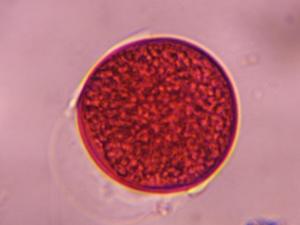 Poaceae pollen under a microscope, verified by PollyMap