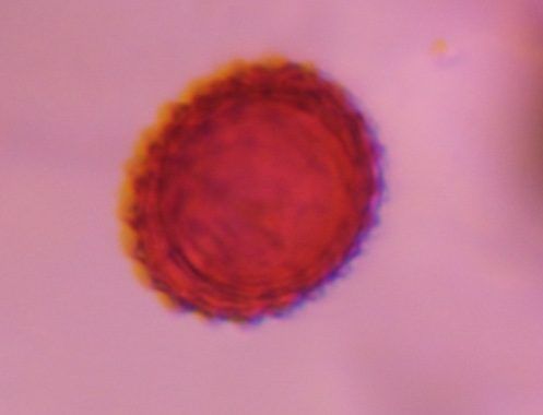 Asteraceae pollen under a microscope, verified by PollyMap