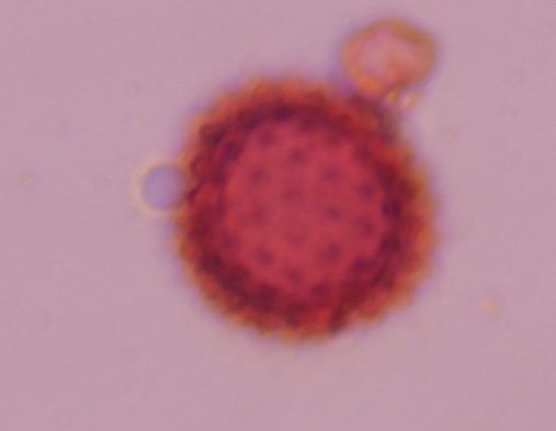 Chenopod pollen under a microscope, verified by PollyMap
