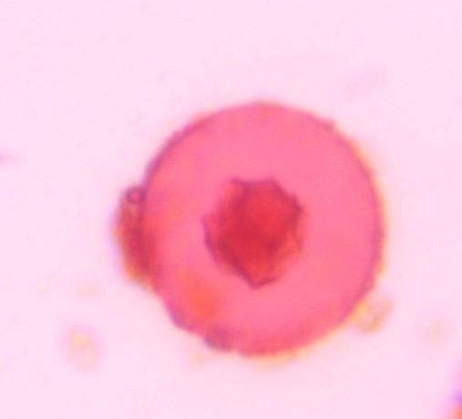 Microscope image of Juniper/Cupressaceae, verified by PollyMap