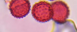 Asteraceae pollen under a microscope, verified by PollyMap