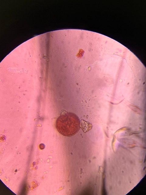 Grass pollen under a microscope, verified by PollyMap
