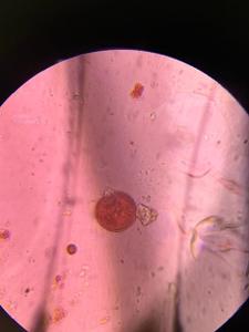 Grass pollen under a microscope, verified by PollyMap