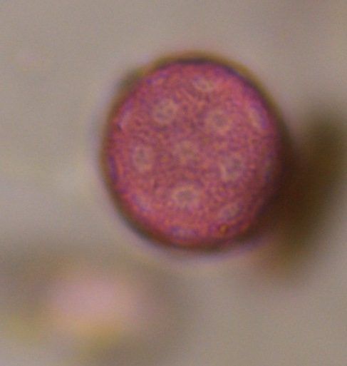 Chenopod pollen under a microscope, verified by PollyMap