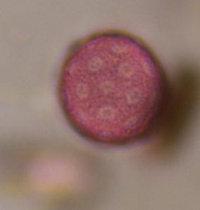 Chenopod pollen under a microscope, verified by PollyMap