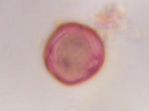 Artemisia pollen under a microscope, verified by PollyMap