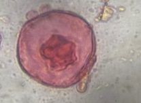 Juniper pollen under a microscope, verified by PollyMap