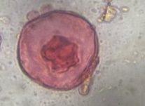 Juniper pollen under a microscope, verified by PollyMap