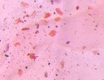 Microscope image of Skin squames / Dander, verified by PollyMap