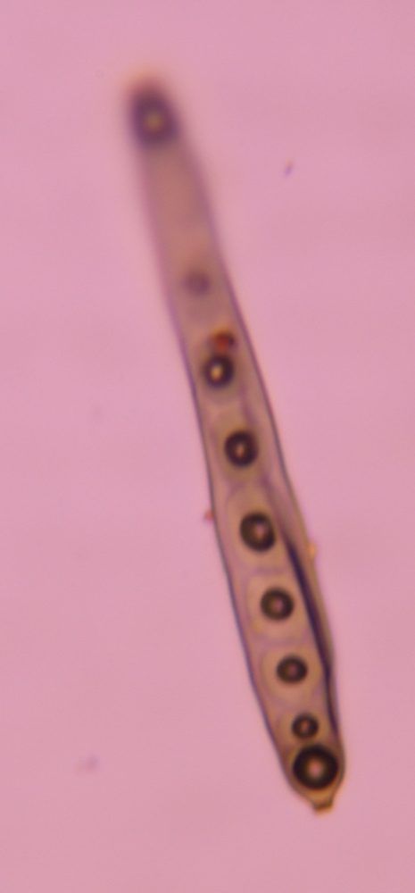 Another microscope image of Bipolaris/Drechslera, verified by PollyMap