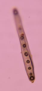 Bipolaris/Drechslera mold spore under a microscope, verified by PollyMap