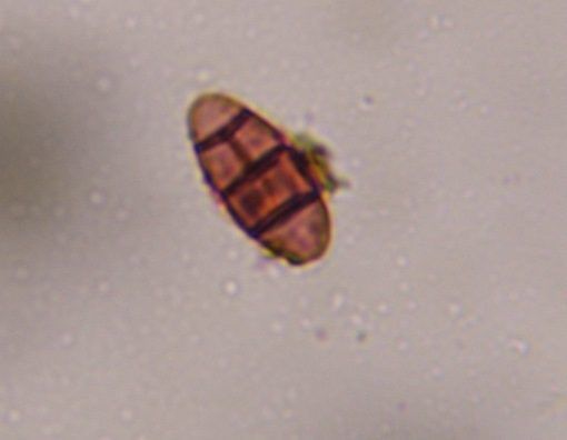 Pithomyces mold spore under a microscope, verified by PollyMap