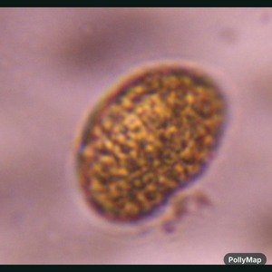 fern spore pollen under a microscope, verified by PollyMap