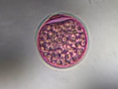 Another microscope image of Poaceae, verified by PollyMap