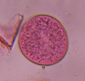 Poaceae pollen under a microscope, verified by PollyMap