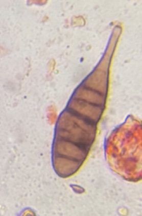 Another microscope image of Alternaria, verified by PollyMap