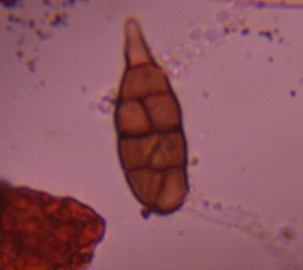 Alternaria mold spore under a microscope, verified by PollyMap