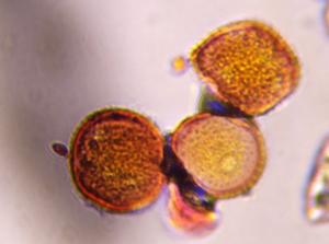 unknown pollen under a microscope, verified by PollyMap