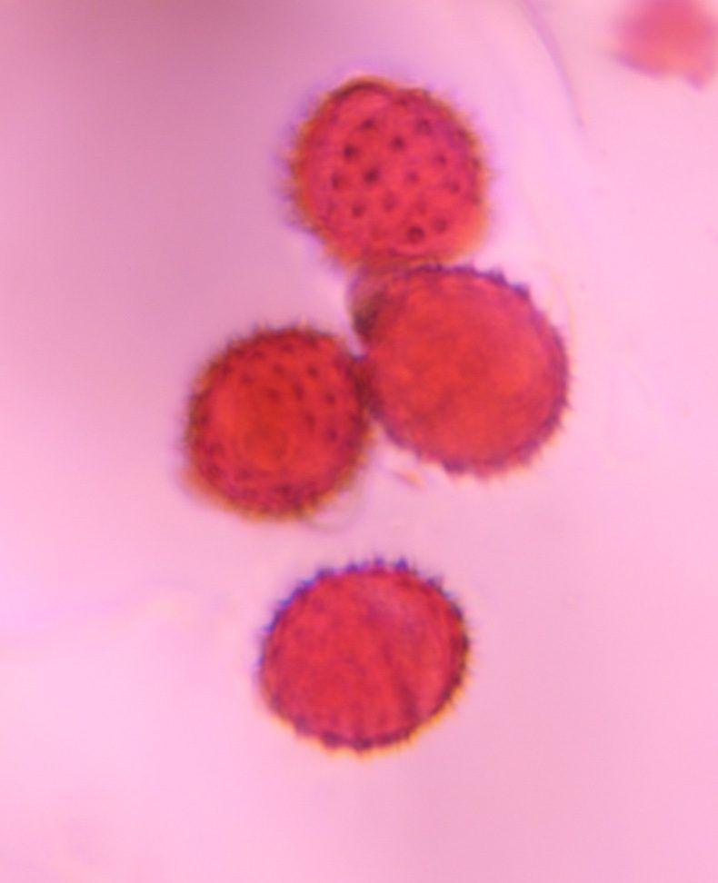 Asteraceae pollen under a microscope, verified by PollyMap