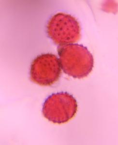 Asteraceae pollen under a microscope, verified by PollyMap