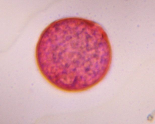 Grass pollen under a microscope, verified by PollyMap