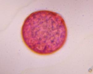 Grass pollen under a microscope, verified by PollyMap
