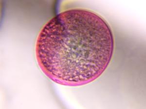 Poaceae pollen under a microscope, verified by PollyMap