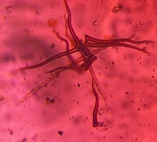 Microscope image of Plant trichome (Stellate leaf hair), verified by PollyMap