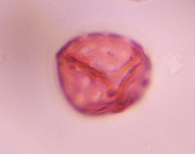 Chenopod pollen under a microscope, verified by PollyMap