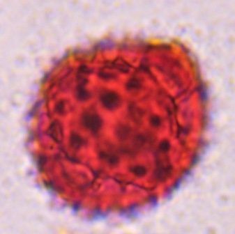 Another microscope image of Asteraceae, verified by PollyMap