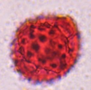 Asteraceae pollen under a microscope, verified by PollyMap