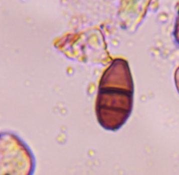 Curvularia mold spore under a microscope, verified by PollyMap