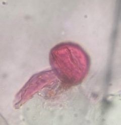 Oak pollen under a microscope, verified by PollyMap
