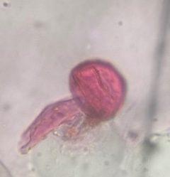 Oak pollen under a microscope, verified by PollyMap