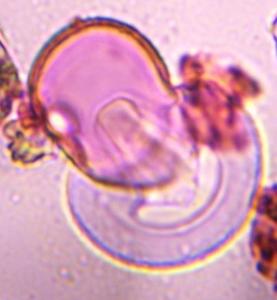 Juniper pollen under a microscope, verified by PollyMap