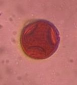 Hackberry pollen under a microscope, verified by PollyMap