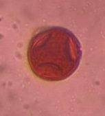 Hackberry pollen under a microscope, verified by PollyMap