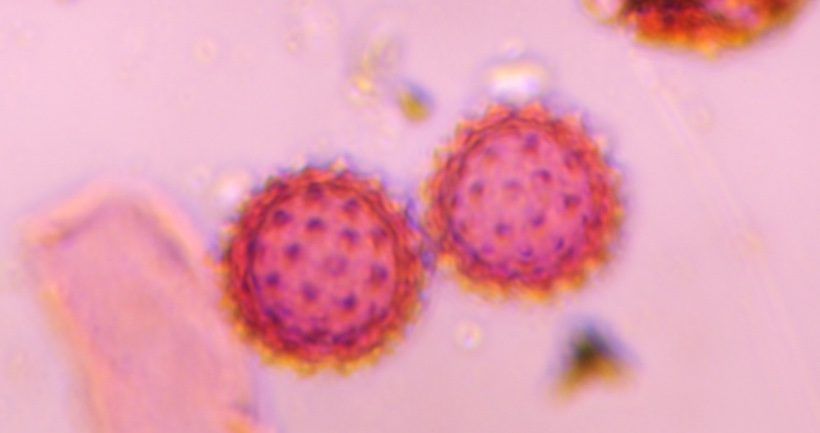 Asteraceae pollen under a microscope, verified by PollyMap