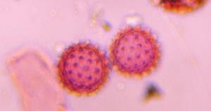 Asteraceae pollen under a microscope, verified by PollyMap