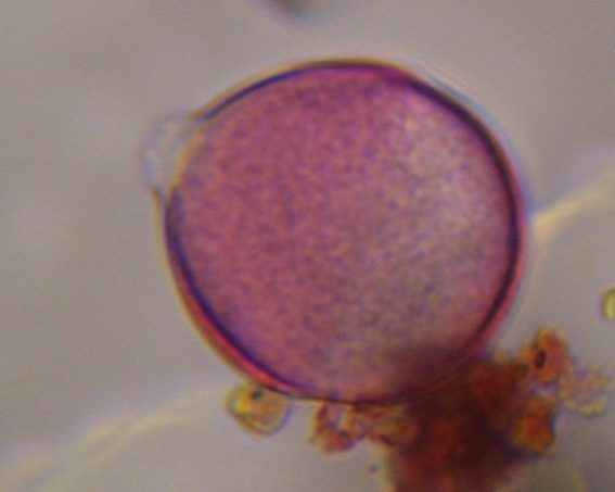 unknown pollen under a microscope, verified by PollyMap