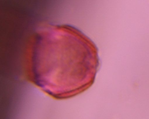 Artemisia pollen under a microscope, verified by PollyMap