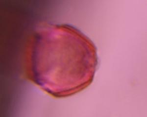 Artemisia pollen under a microscope, verified by PollyMap