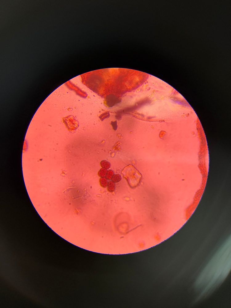 Epicoccum mold spore under a microscope, verified by PollyMap