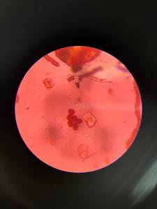 Epicoccum mold spore under a microscope, verified by PollyMap