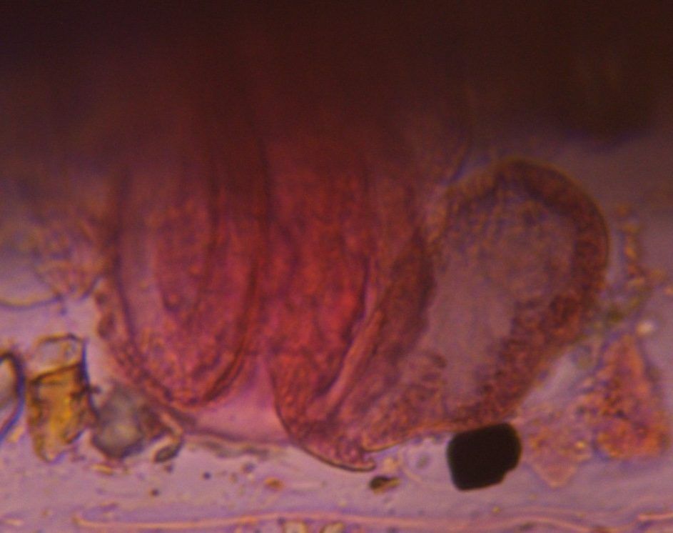 Pine pollen under a microscope, verified by PollyMap