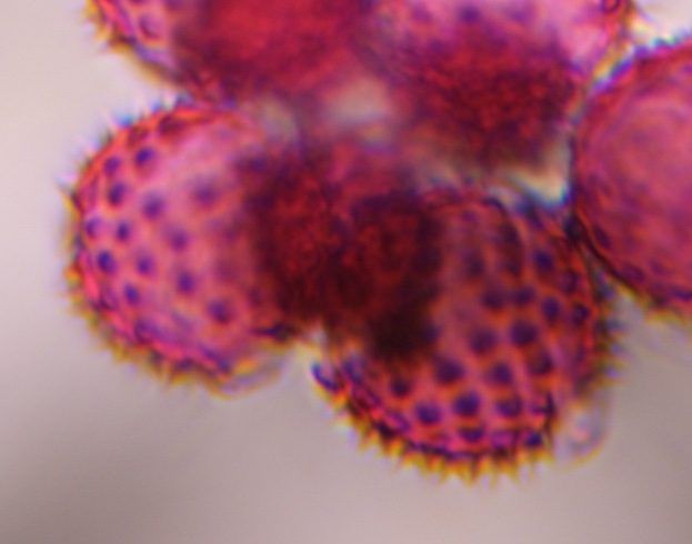 Asteraceae (low spine) pollen under a microscope, verified by PollyMap