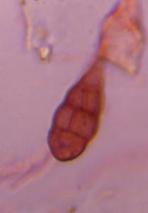 Alternaria mold spore under a microscope, verified by PollyMap