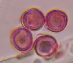 Artemisia pollen under a microscope, verified by PollyMap