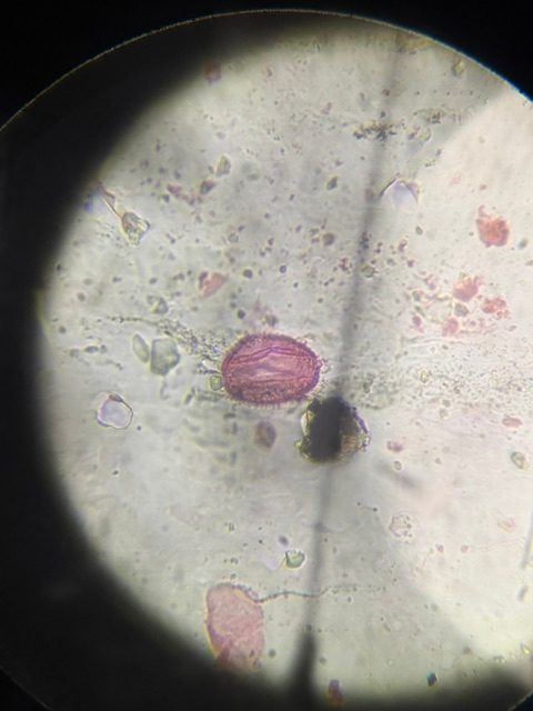 Olive pollen under a microscope, verified by PollyMap