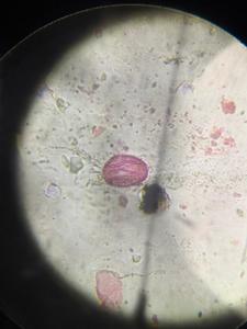 Olive pollen under a microscope, verified by PollyMap